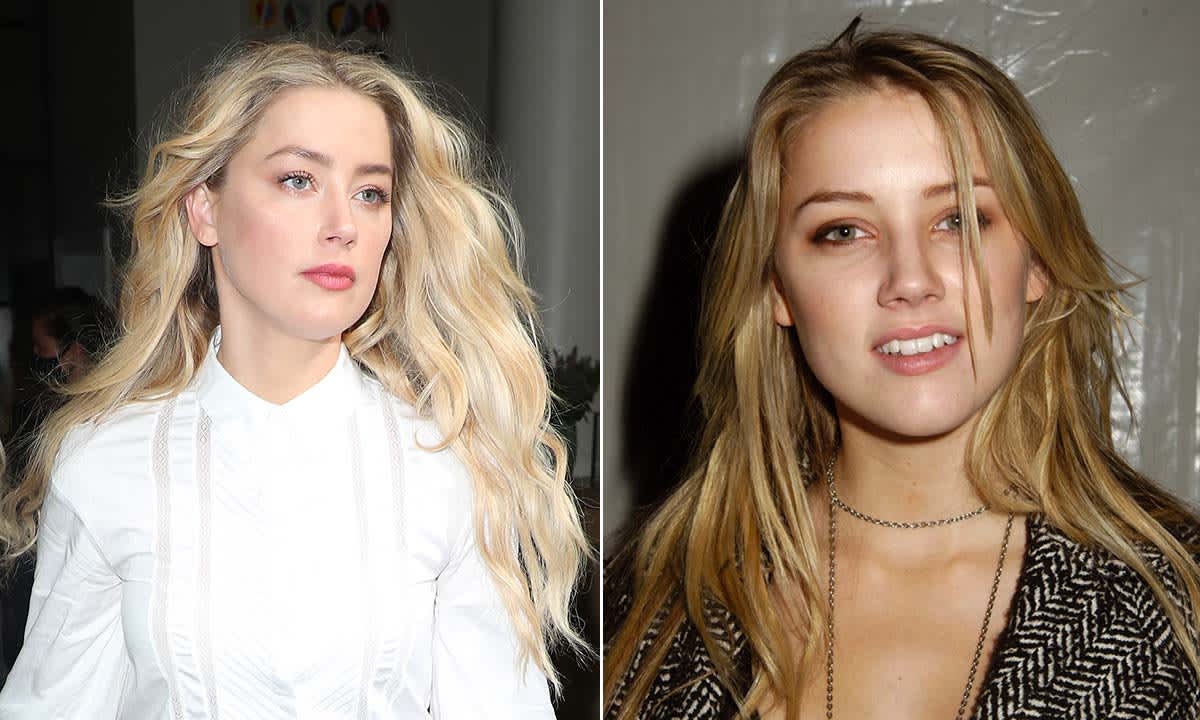 Amber Heard plastic surgery: TikTok plastic surgeon reveals Johnny Depp’s ex-wife’s facial transformation